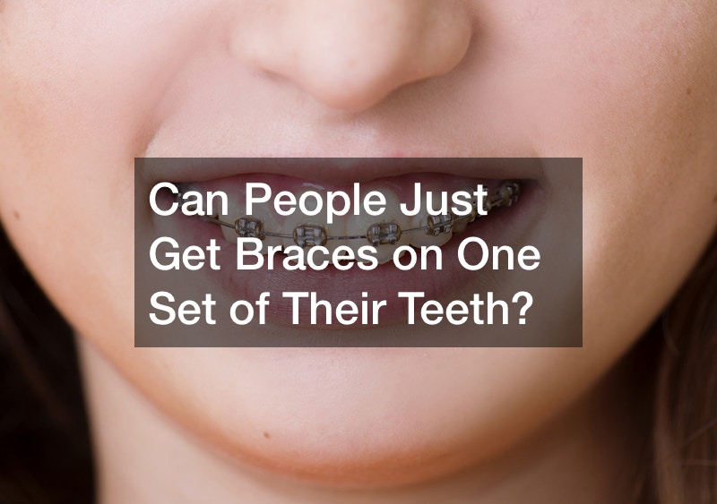 Can People Just Get Braces on One Set of Their Teeth?